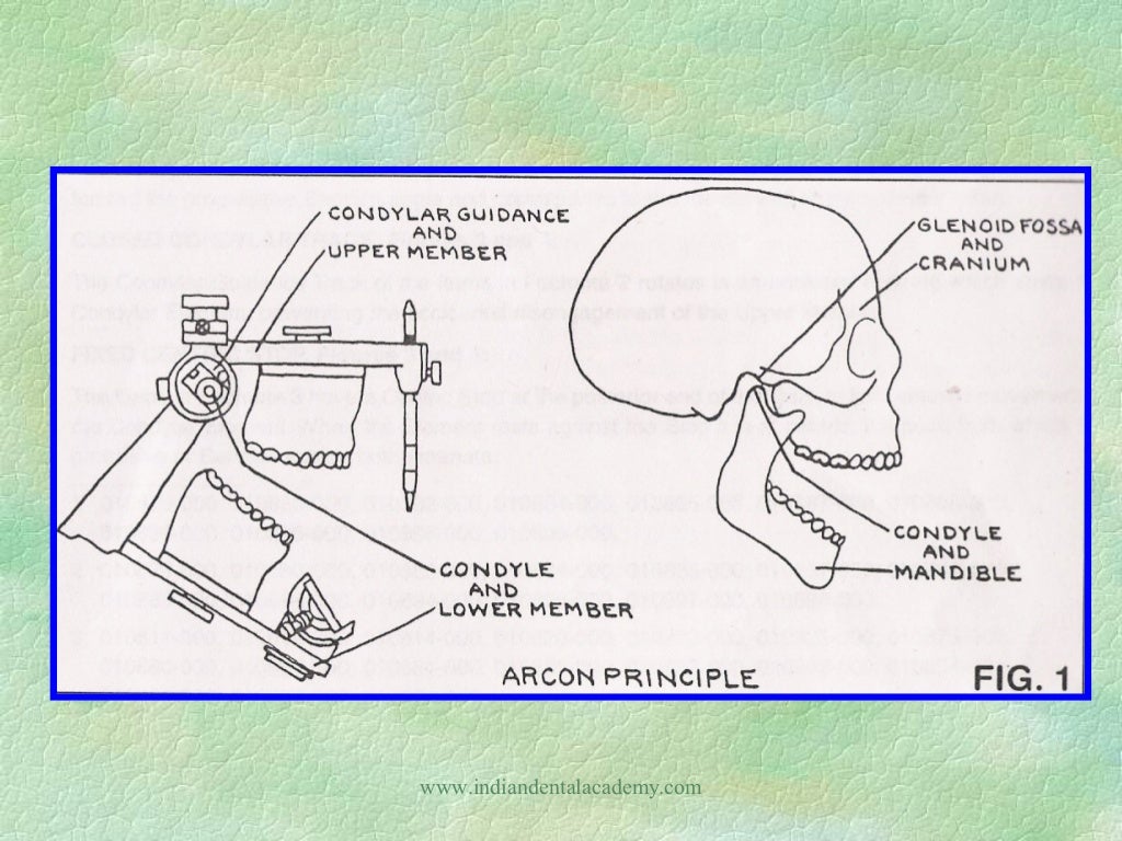 Dental articulators dental courses