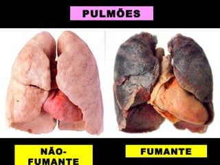 NÃO-
FUMANTE
FUMANTE
PULMÕES
 