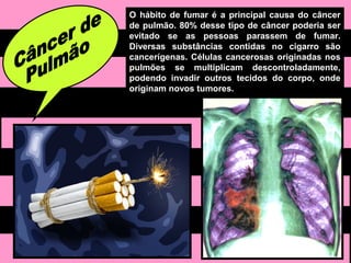 O hábito de fumar é a principal causa do câncer
de pulmão. 80% desse tipo de câncer poderia ser
evitado se as pessoas parassem de fumar.
Diversas substâncias contidas no cigarro são
cancerígenas. Células cancerosas originadas nos
pulmões se multiplicam descontroladamente,
podendo invadir outros tecidos do corpo, onde
originam novos tumores.
 