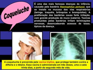 É uma das mais famosas doenças da infância,
causada pela bactéria Haemophilus pertussi, que
se instala na mucosa das vias respiratórias
(laringe, traquéia, brônquios e bronquíolos). A
proliferação das bactérias causa forte irritação,
com grande produção de muco (catarro). Toxinas
produzidas pelas bactérias irritam terminações
nervosas, desencadeando acessos de tosse,
típicos da doença.
A coqueluche é prevenida pela vacina tríplice, que protege também contra a
difteria e o tétano. Essa vacina é administrada em três doses, uma a cada
trinta dias, a partir do segundo mês de vida.
 