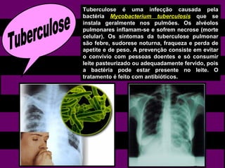 Tuberculose é uma infecção causada pela
bactéria Mycobacterium tuberculosis que se
instala geralmente nos pulmões. Os alvéolos
pulmonares inflamam-se e sofrem necrose (morte
celular). Os sintomas da tuberculose pulmonar
são febre, sudorese noturna, fraqueza e perda de
apetite e de peso. A prevenção consiste em evitar
o convívio com pessoas doentes e só consumir
leite pasteurizado ou adequadamente fervido, pois
a bactéria pode estar presente no leite. O
tratamento é feito com antibióticos.
 