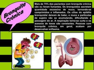 Mais de 75% dos pacientes com bronquite crônica
são ou foram fumantes. Os bronquíolos secretam
quantidade excessiva de muco, tornando-se
comprimidos e inflamados. Os cílios do epitélio
bronquiolar deixam de bater, e muco e partículas
de sujeira vão se acumulando, dificultando a
passagem do ar. A respiração torna-se curta e os
acessos de tosse são constantes. Pessoas com
bronquite crônica, em geral, acabam por
desenvolver enfisema.
 