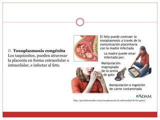 B. Toxoplasmosis congénita
Los taquizoítos, pueden atravesar
la placenta en forma extracelular o
intracelular, e infectar al feto.
http://periodicomedico.com/toxoplasmosis-la-enfermedad-de-los-gatos/
 