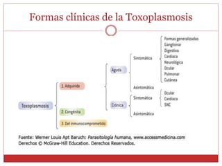 Formas clínicas de la Toxoplasmosis
 