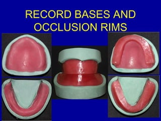 RECORD BASES AND
OCCLUSION RIMS
 