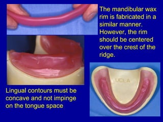 The mandibular wax
rim is fabricated in a
similar manner.
However, the rim
should be centered
over the crest of the
ridge....