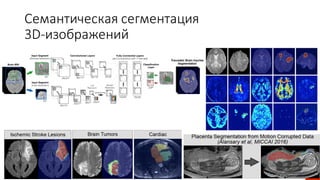 Семантическая	сегментация	
3D-изображений
 