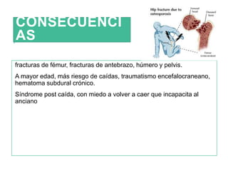 CONSECUENCI
AS
fracturas de fémur, fracturas de antebrazo, húmero y pelvis.
A mayor edad, más riesgo de caídas, traumatismo encefalocraneano,
hematoma subdural crónico.
Síndrome post caída, con miedo a volver a caer que incapacita al
anciano
 