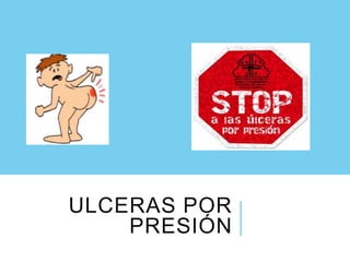 ULCERAS POR
PRESIÓN
 