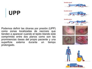 UPP
Podemos definir las úlceras por presión (UPP)
como zonas localizadas de necrosis que
tienden a aparecer cuando el tejido blando está
comprimido entre dos planos como son las
prominencias óseas del propio paciente y una
superficie externa durante un tiempo
prolongado.
 