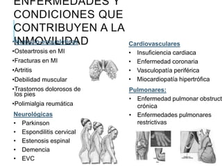 ENFERMEDADES Y
CONDICIONES QUE
CONTRIBUYEN A LA
INMOVILIDAD•Musculo-esqueléticas
•Osteartrosis en MI
•Fracturas en MI
•Artritis
•Debilidad muscular
•Trastornos dolorosos de
los pies
•Polimialgia reumática
Neurológicas
• Parkinson
• Espondilitis cervical
• Estenosis espinal
• Demencia
• EVC
Cardiovasculares
• Insuficiencia cardiaca
• Enfermedad coronaria
• Vasculopatía periférica
• Miocardiopatía hipertrófica
Pulmonares:
• Enfermedad pulmonar obstructi
crónica
• Enfermedades pulmonares
restrictivas
 