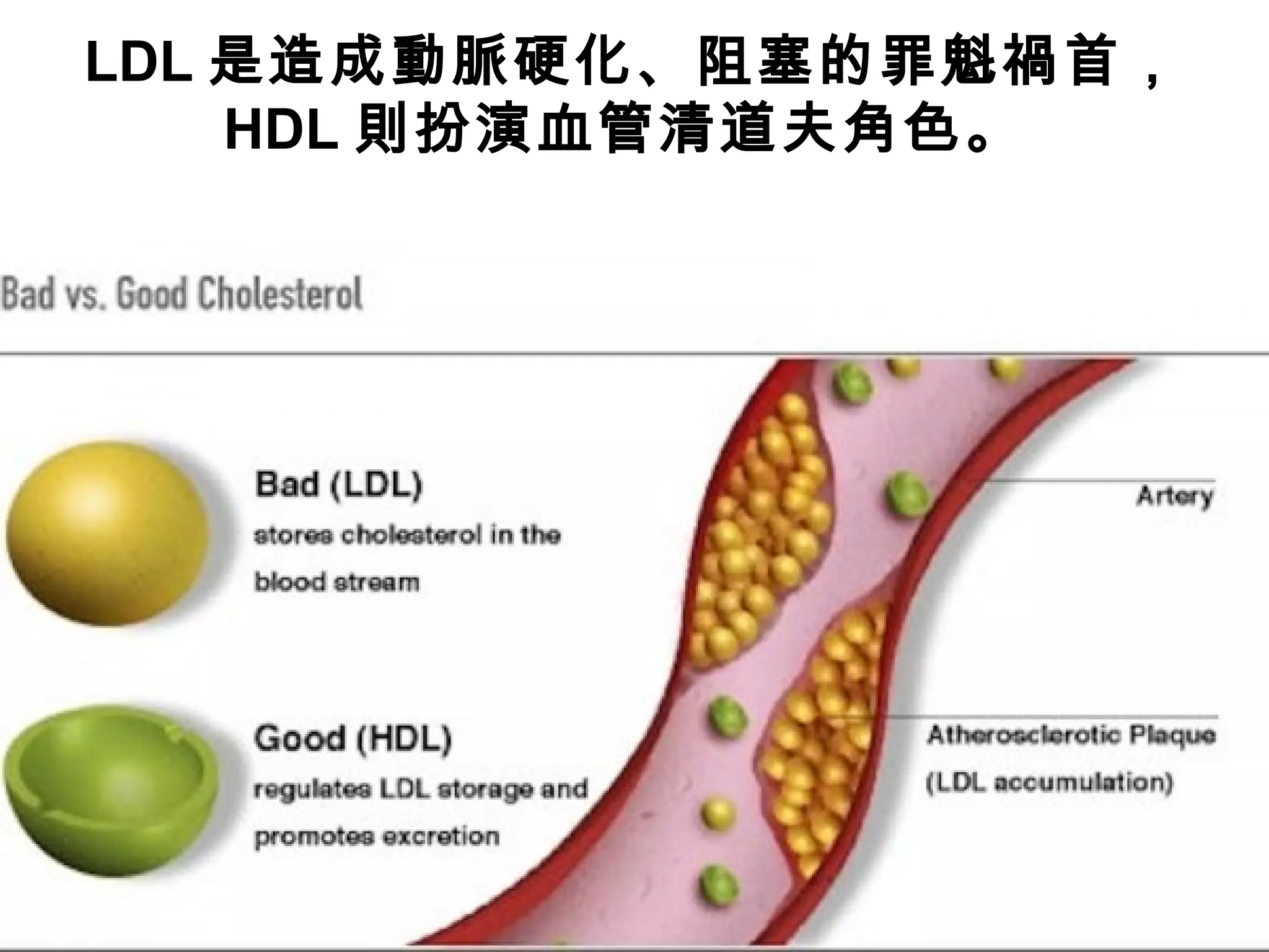 LDL 是造成動脈硬化、阻塞的罪魁禍首，
HDL 則扮演血管清道夫角色。
 