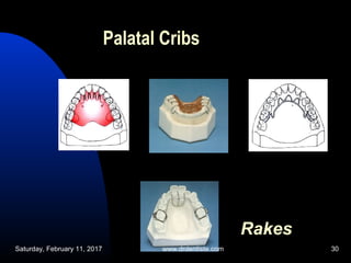 Paltal Rake open bite and deep bite | PPT