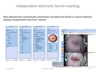 Independent electronic bench-marking
02.05.2009 14(c) asthenis GmbH
Data collected were automatically anonymized, encrypted and stored in a secure relational
database located within the clinics’ network
 