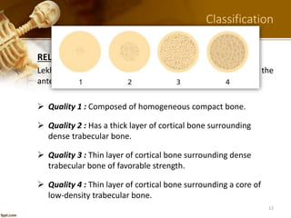 5. alveolar bone in health part a dr-ibrahim_shaikh | PPTX