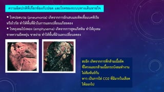 ความผิดปกติที่เกี่ยวข้องกับปอด และโรคของระบบทางเดินหายใจ
 โรคปอดบวม (pneumonia) เกิดจากการอักเสบและติดเชือแบคทีเรีย
หรือไวรัส ท้าให้พืนที่ผิวในการแลกเปลี่ยนแก๊สลดลง
 โรคถุงลมโป่งพอง (emphysema) เกิดจากการสูดแก๊สพิษ ท้าให้ถุงลม
ขาดความยืดหยุ่น ขาดง่าย ท้าให้พืนที่ผิวแลกเปลี่ยนลดลง
สะอึก เกิดจากการที่กล้ามเนือยึด
ซี่โครงและกล้ามเนือกระบังลมท้างาน
ไม่สัมพันธ์กัน
หาว เป็นการไล่ CO2 ที่มีมากในเลือด
ให้ออกไป
 