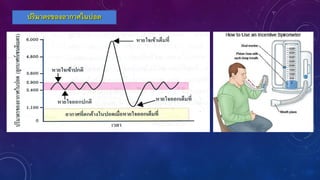 ปริมาตรของอากาศในปอด
 
