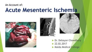 Acute Mesenteric Ischemia
 Dr. Debayan Chowdhury
 22.02.2017
 Malda Medical Collegewww.surgical-tutor.org.uk
An Account of:
 