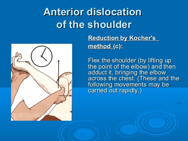 Fracture Of Shoulder And Humerus