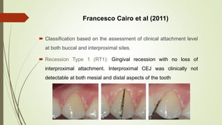 5.gingival recession seminar | PPTX