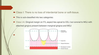 5.gingival recession seminar | PPTX