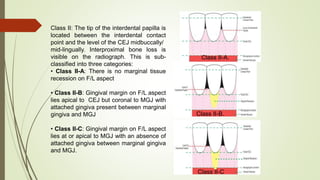 5.gingival recession seminar | PPTX