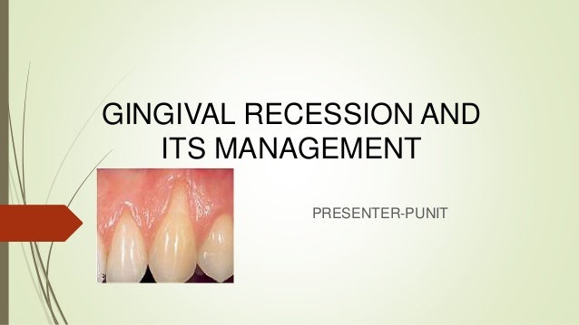 5 gingival recession seminar gingival recession