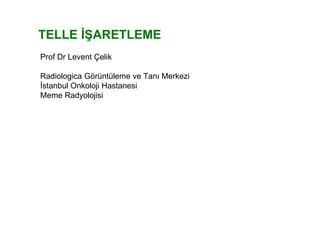 TELLE İŞARETLEME
Prof Dr Levent Çelik
Radiologica Görüntüleme ve Tanı Merkezi
İstanbul Onkoloji Hastanesi
Meme Radyolojisi
 
