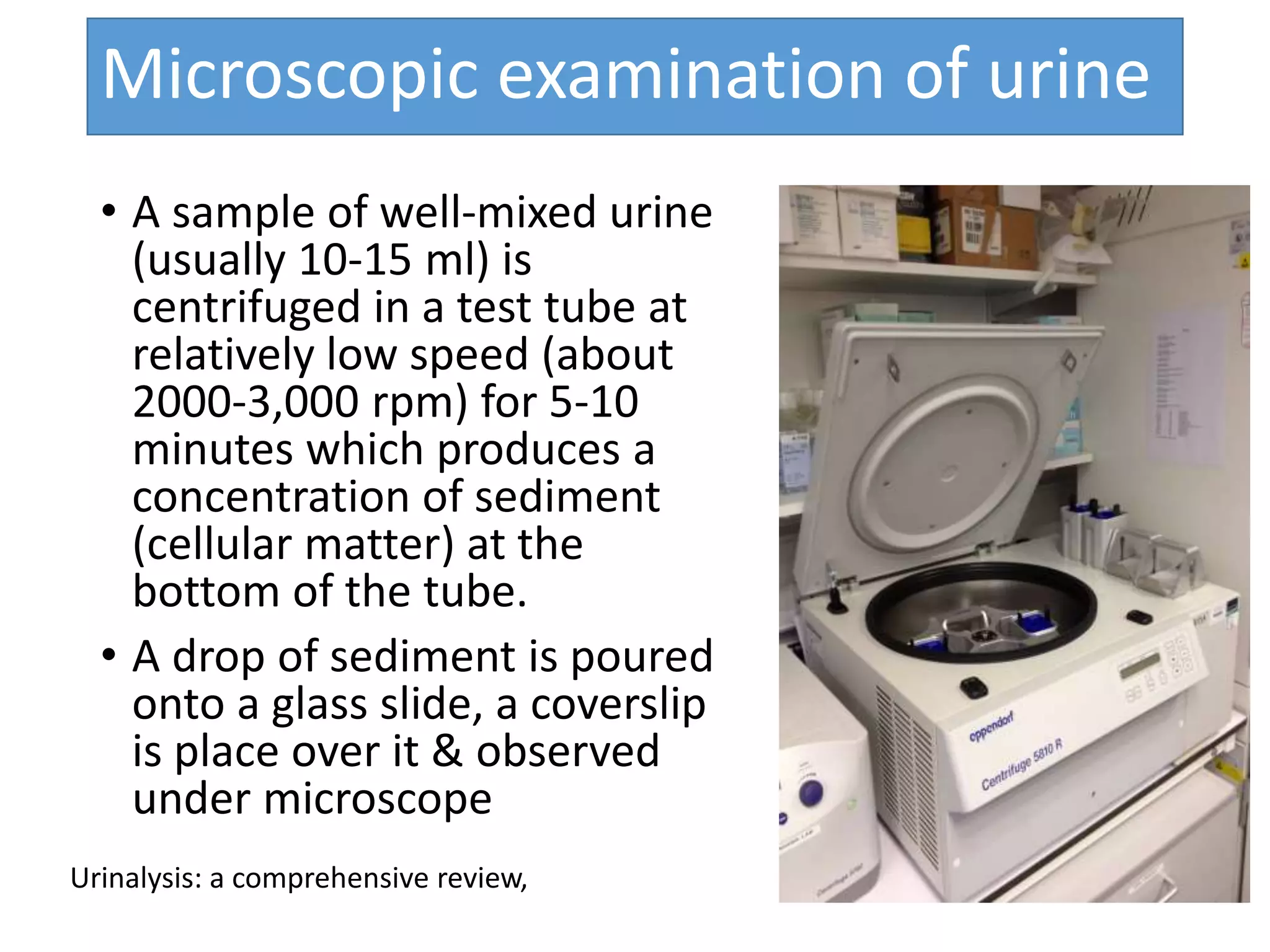 Urine analysis | PPTX
