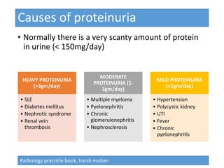 Causes of proteinuria
• Normally there is a very scanty amount of protein
in urine (< 150mg/day)
HEAVY PROTEINURIA
(>3gm/day)
• SLE
• Diabetes mellitus
• Nephrotic syndrome
• Renal vein
thrombosis
MODERATE
PROTEINURIA (1-
3gm/day)
• Multiple myeloma
• Pyelonephritis
• Chronic
glomerulonephritis
• Nephrosclerosis
MILD PROTEINURIA
(<1gm/day)
• Hypertension
• Polycystic kidney
• UTI
• Fever
• Chronic
pyelonephritis
Pathology practicle book, harsh mohan
 