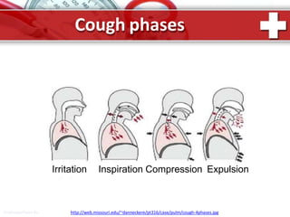 Cough phases
Irritation
ProPowerPoint.Ru http://web.missouri.edu/~danneckere/pt316/case/pulm/cough-4phases.jpg
Inspiration Compression Expulsion
 