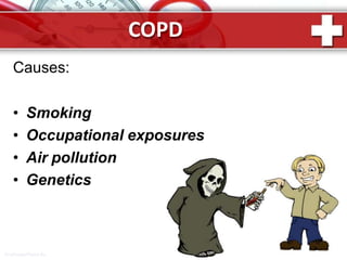 COPD
Causes:
• Smoking
• Occupational exposures
• Air pollution
• Genetics
ProPowerPoint.Ru
 