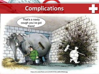 Complications
That’s a nasty
cough you’ve got
there!
https://c1.staticflickr.com/1/3/4573720_b681299daf.jpg
 