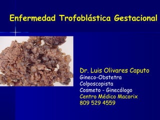 Enfermedad Trofoblástica Gestacional
Dr. Luis Olivares Caputo
Gineco-Obstetra
Colposcopista
Cosmeto - Ginecólogo
Centro Médico Macorix
809 529 4559
 