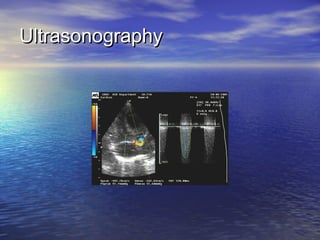 UltrasonographyUltrasonography
 