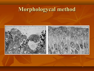 Morphologycal methodMorphologycal method
 