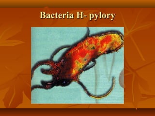 Bacteria H- pyloryBacteria H- pylory
 