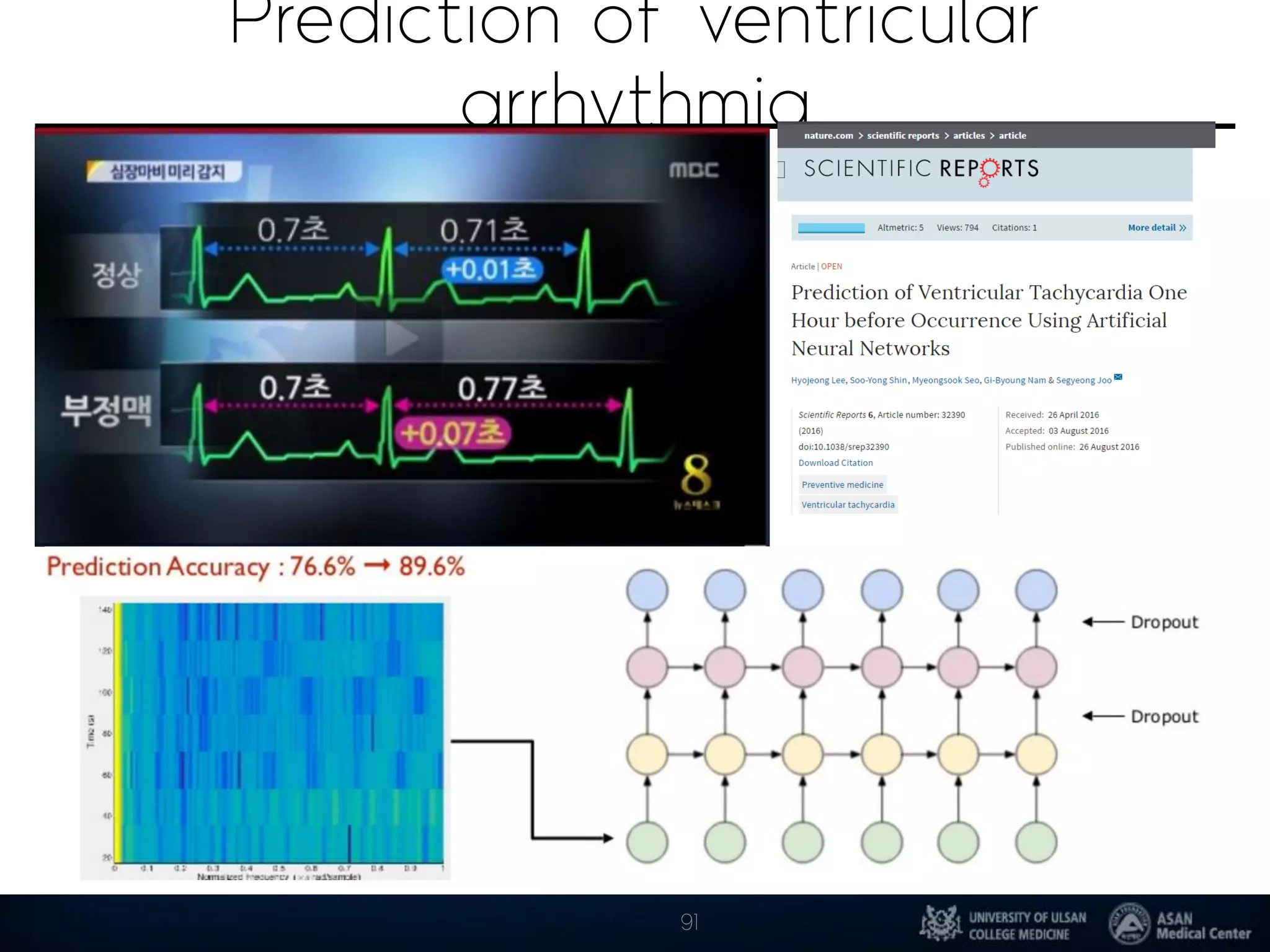 Prediction of ventricular
arrhythmia
91
 