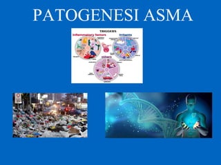 PATOGENESI ASMA
 