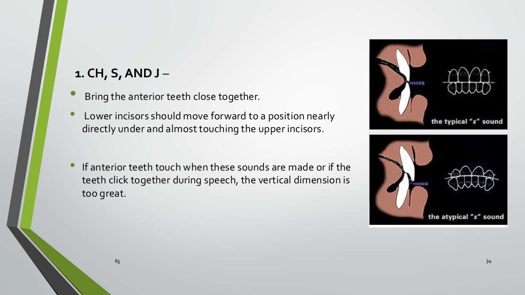 Vertical jaw relation in Complete Dentures Kelly