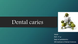 Dental caries
Sohail
PGT: 1st yr
Dept of pedodontics
SVS Institute of Dental Sciences.
1
 