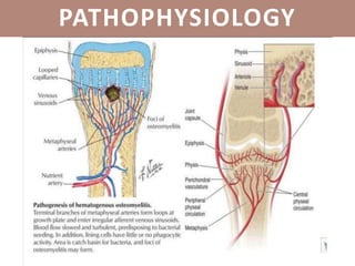 PATHOPHYSIOLOGY
 