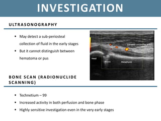 INVESTIGATION
ULT RASONOGRAPHY
 May detect a sub-periosteal
collection of fluid in the early stages
 But it cannot distinguish between
hematoma or pus
B ONE SCAN (RADI ONUCL I DE
SCANNI NG)
 Technetium – 99
 Increased activity in both perfusion and bone phase
 Highly sensitive investigation even in the very early stages
 