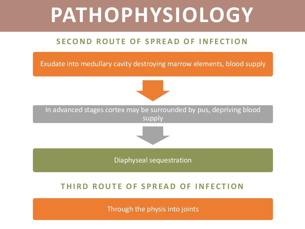 Acute Osteomyelitis