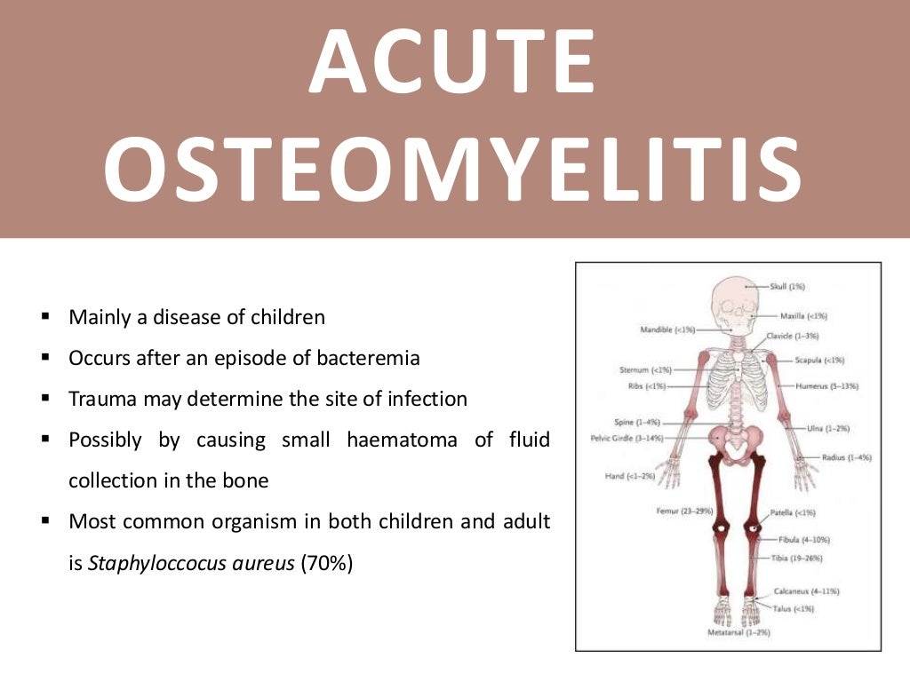 Acute Osteomyelitis