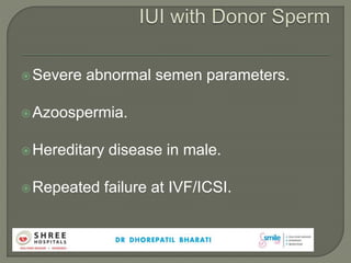 Severe abnormal semen parameters.
Azoospermia.
Hereditary disease in male.
Repeated failure at IVF/ICSI.
 