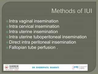 Intra vaginal insemination
Intra cervical insemination
Intra uterine insemination
Intra uterine tuboperitoneal insemination
Direct intra peritoneal insemination
Fallopian tube perfusion .
 