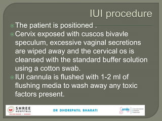 The patient is positioned .
Cervix exposed with cuscos bivavle
speculum, excessive vaginal secretions
are wiped away and the cervical os is
cleansed with the standard buffer solution
using a cotton swab.
IUI cannula is flushed with 1-2 ml of
flushing media to wash away any toxic
factors present.
 