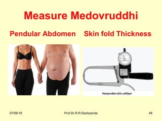Measure Medovruddhi
Pendular Abdomen Skin fold Thickness
07/06/18 Prof.Dr.R.R.Deshpande 48
 