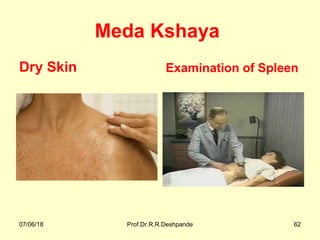 Meda Kshaya
Dry Skin Examination of Spleen
07/06/18 Prof.Dr.R.R.Deshpande 62
 
